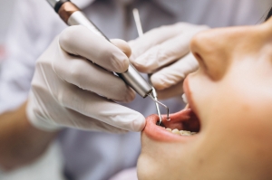 Top 10 Dentists in Montrose Offering Exceptional Dental Services